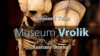 Museum Vrolik  Anatomy Stories 1 Conjoined Twins [upl. by Htabmas]