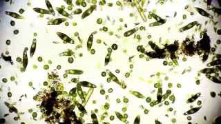 Mikroorganismen  microorganisms  Leben im Teich  life microcosmos 1080p Full HD [upl. by Ganiats]