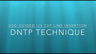 CVP line Insertion using DNTP technique [upl. by Rednaskela323]