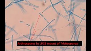 Arthroconidia of Trichosporon inkin Showing Long Cylindrical in Shape [upl. by Pitchford]