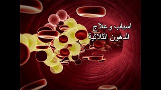 أسباب ارتفاع الدهون الثلاثية والكوليسترول والعلاج الوحيد له [upl. by Amelita]