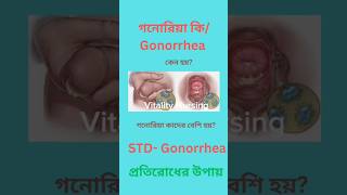 গনোরিয়া কি  what is Gonorrhea stds sexualdisease যৌনবাহিতরোগ [upl. by Gross]