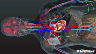 AED in Action  A 3D look inside the body [upl. by Ikcim]