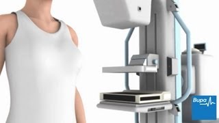 How a mammogram is carried out  Bupa Health [upl. by Letnuhs]