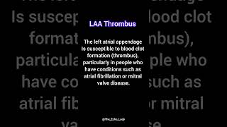 LAA Thrombus Cardiology echocardiogram echocardiography heartscan EGC medicine [upl. by Kentigera871]