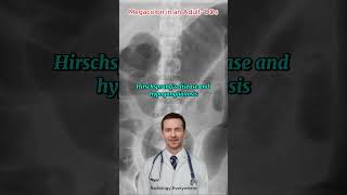 7 Surprising Causes of Megacolon You Need to Know [upl. by Hseham]