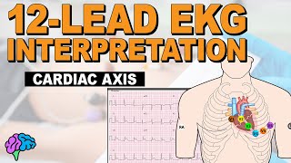 Understanding Cardiac Axis and Deviations  12Lead EKG [upl. by Nibaj]