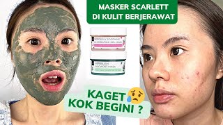 REVIEW MASKER BARU SCARLETT DI KULIT BERJERAWAT Cocok amp Bagus Ga [upl. by Zea]