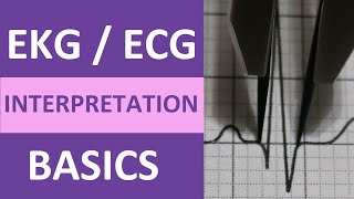 EKGECG Interpretation Basics Nursing NCLEX  QRS Complex P Wave T Wave PR Interval [upl. by Beal215]