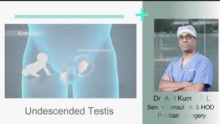 Undescended Testis Cryptorchidism  Sakra World Hospital [upl. by Wendell635]