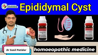 EPIDIDYMAL CYST homeopathic treatment amp medicines  Dr Sunil Patidar [upl. by Laverna]