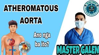 Ano ang Atheromatous Aorta [upl. by Jessabell581]