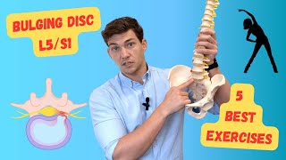 Bulging Disc L5S1 The 5 Best Exercises Explained in Detail [upl. by Prouty]