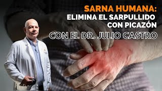 ¿Cuáles son los síntomas de la sarna humana II Parte Médico con Julio Castro [upl. by Eyr]