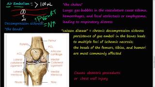 62P  Air Embolism decompression sickness the bends the chokes cassion disease [upl. by Lime]