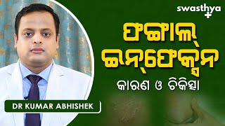 ଫଙ୍ଗାଲ୍ ଇନଫେକ୍ସନ  କେମିତି କରିବେ ଚିକିତ୍ସା  Dr Kumar Abhishek on Fungal Infection Treatment in Odia [upl. by Kathryne]