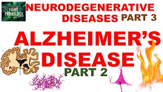 NEURODEGENERATIVE DISEASES PART 3 ALZHEIMER DISEASE Morphology Clinical Features amp Treatment [upl. by Aoniak]