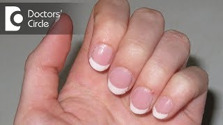 How to manage bluish nails on exposure to cold with Panic Disorder  Dr Sanjay Panicker [upl. by Nosreme]