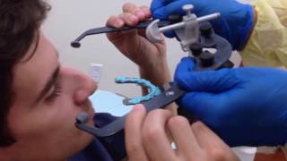 Clinical Demonstration of How to Use a Facebow [upl. by Ahseram]