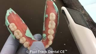 Scanning Radiopaque PVS Relined Denture with TRIOS amp Guide Workflow [upl. by Kathie]