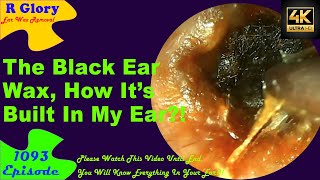 The Black Ear Wax🤦‍♀️How Was Its Built In My Ear🤷‍♂️New Video Ear Wax Removal 1093 ear health [upl. by Pine]