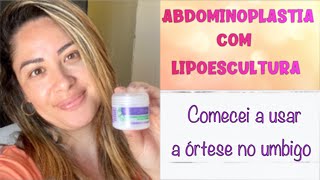 Colocando a órtese no umbigo abdominoplastia com lipoescultura  por Thaís Ortiz [upl. by Odnalor]