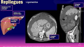 2 Cavidad peritoneal mesenterio y pared abdominal [upl. by Cleti]