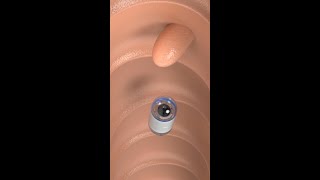 Capsule Endoscopy science shorts medicine [upl. by Edrahc]