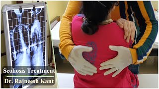 Scoliosis Treatment  Non Surgical Management Of Scoliosis  Dr Rajneesh Kant [upl. by Bartle196]