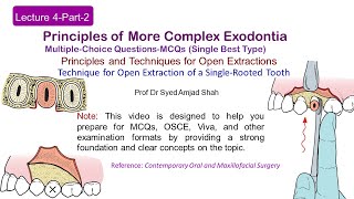 Lecture 4 Part2 MCQs  Open Extraction of Single Rooted Tooth  MultipleChoice Questions [upl. by Nnylf]