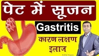 पेट में सूजन gastritis कारण लक्षण इलाज।gastritis in hindi [upl. by Weatherley]