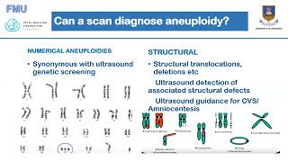 Aneuploidy Screening Dr C Chirume [upl. by Nahsin657]