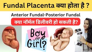 Fundal Placenta क्या होता है  Fundo Anterior Fundo Posterior Placenta Placenta Position Pregnancy [upl. by Barnes]