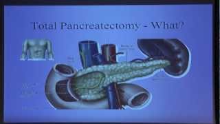 Pancreatic Cancer Awareness Day  Total Pancreatectomy Dr John Chabot 3 [upl. by Hercules]