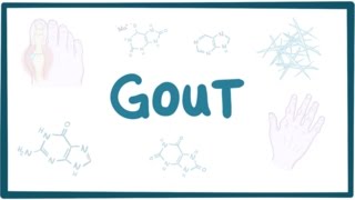 Gout  causes symptoms diagnosis treatment pathology [upl. by Eiramrebma]