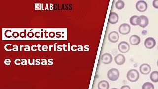 Codócitos características e causas  Alterações no eritrograma [upl. by Hort]