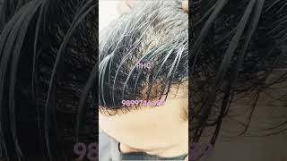 Skin Base Hair Patch Wigs  100 Natural Look hairreplacement hairsystem shorts viral tiktok [upl. by Elisabet151]