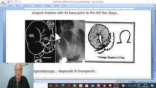 Intestinal disorders in Arabic 10  Volvulus  part 2   by Dr Wahdan [upl. by Gone]