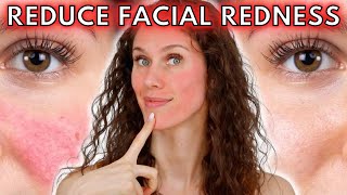 🔴 5 Reasons Your Face Is Always Red Rosacea to Dermatographia amp Everything Inbetween [upl. by Etna]