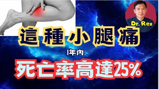 中英字幕EngSub腳痛好小事？如果有周邊血管病1年死亡率25 Peripheral vascular disease has a ridiculous high mortality [upl. by Kamilah296]