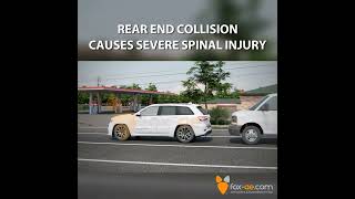 Rear End Collision Causes Severe Spinal Injury [upl. by Ahsiemac]