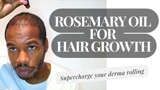 Rosemary Oil for Hair Growth  Supercharge Your Derma Rolling [upl. by Dmitri]