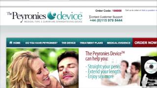 Peyronies Cure  How I Cured Peyronies DRUG Free [upl. by Ahsielat]