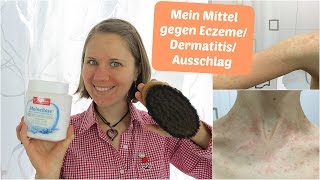 Mein Mittel gegen Hautprobleme Ekzeme Dermatitis Ausschlag etc [upl. by Opportuna]