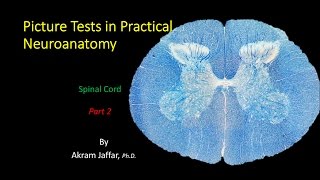 Picture Test in Neuroanatomy Spinal Cord 2 [upl. by Ariaj430]