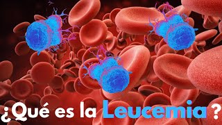 ¿Qué es la Leucemia [upl. by Concettina]