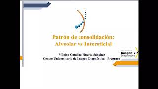 Patrón de consolidación alveolar vs intersticial [upl. by Akisej118]