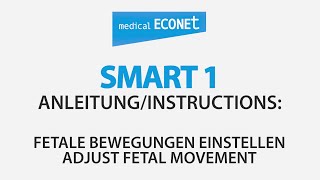 Smart 1 Fetale Bewegung einstellen  Adjust Fetal Movement [upl. by Ymmot229]