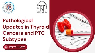 Pathological Updates in Thyroid Cancers and PTC Subtypes [upl. by Einavoj]