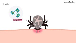FSME Welche Krankheiten übertragen Zecken [upl. by Tadeas]